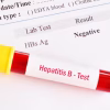 At-Home Hepatitis B Self-Screening Test