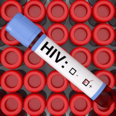 HIV PCR Confirmatory Test – Early (7–10 Days) & Conclusive HIV Diagnosis in Kenya
