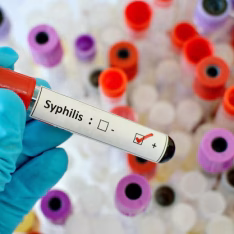 At-Home HIV & Syphilis Self-Screening Test